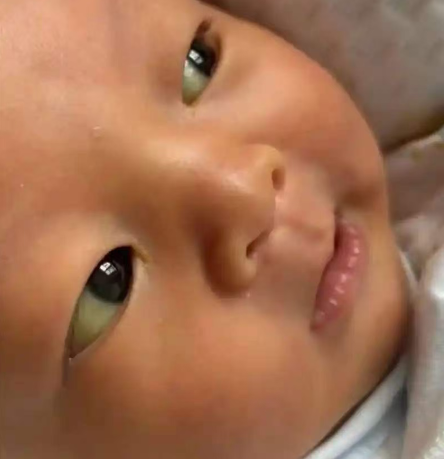 【科普】新生儿的一些特殊表现，你了解吗？