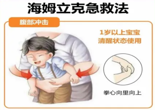 【科普】黄金4分钟-儿童海姆立克急救法！